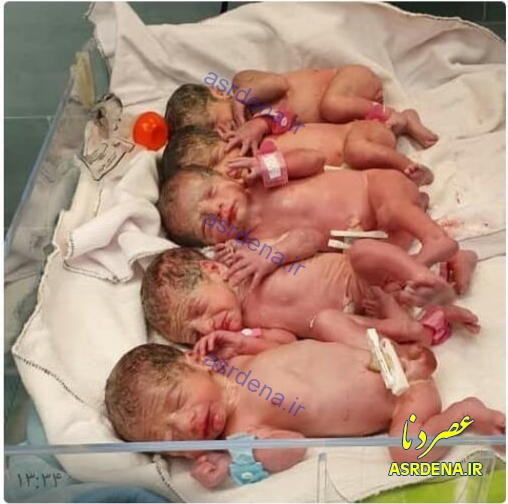 تولد ۵ قلو در بیمارستان بی بی حکیمه خاتون گچساران+  تصاویر