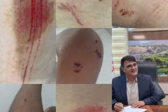 حمله سگ ولگرد به نوجوان در کمربندی ساحلی یاسوج؛ شهرداری پاسخ دهد